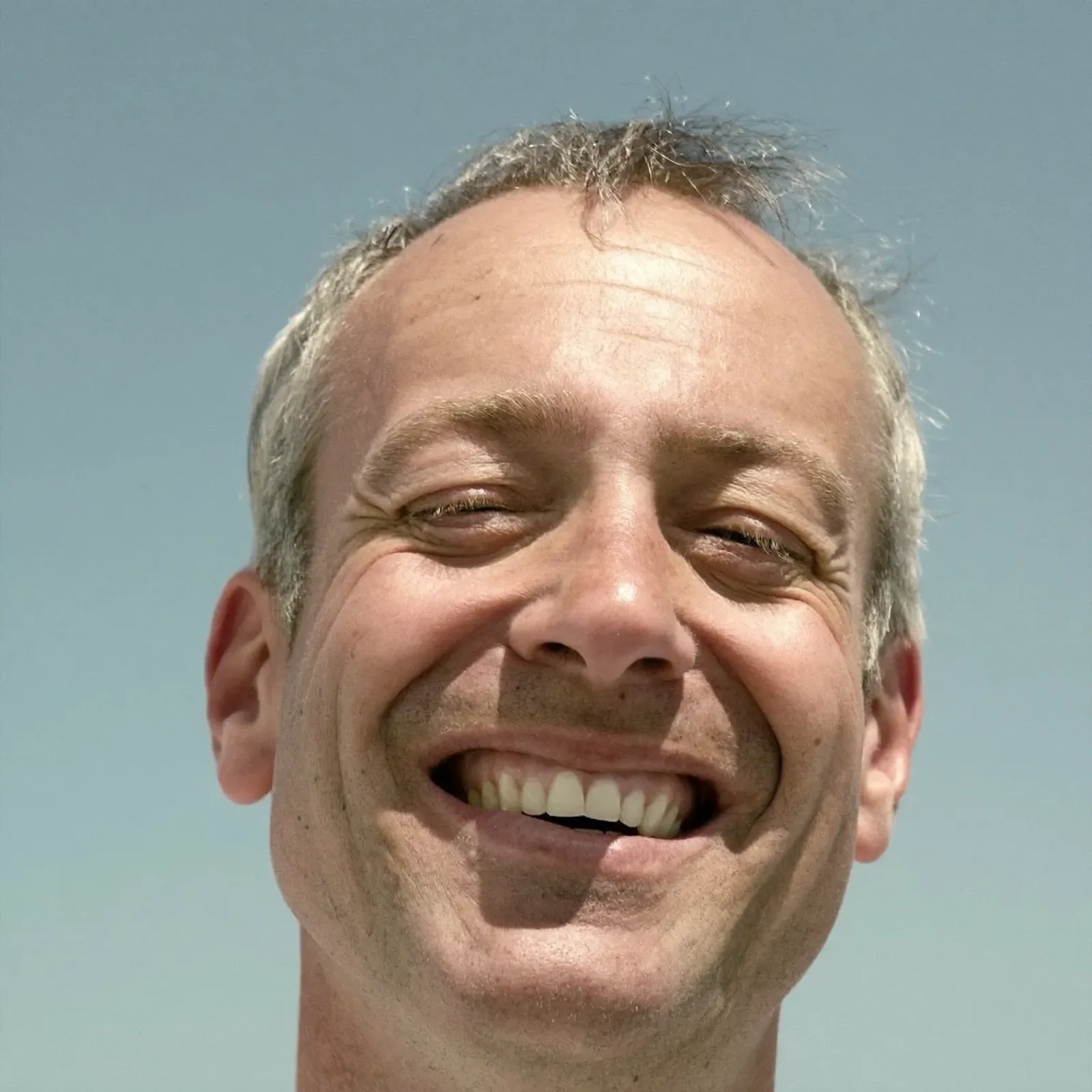 A patient smiling after treatment