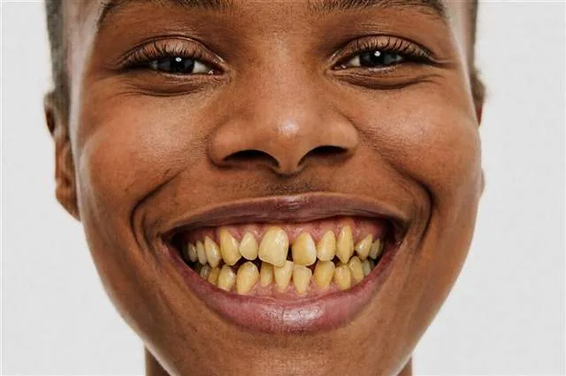 Smile before simulation